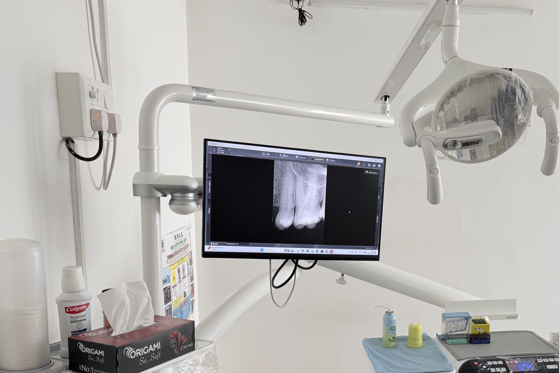 A chairside monitor in the treatment room showing a digital dental X-ray, with the overhead treatment light and a prepared instrument tray alongside.